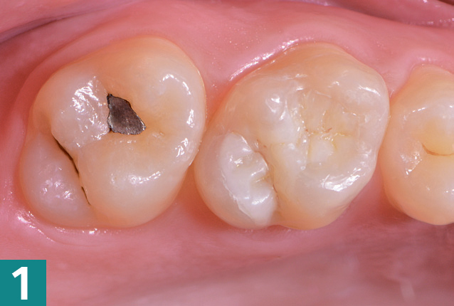 Реставрация DMG Constic - этап 1